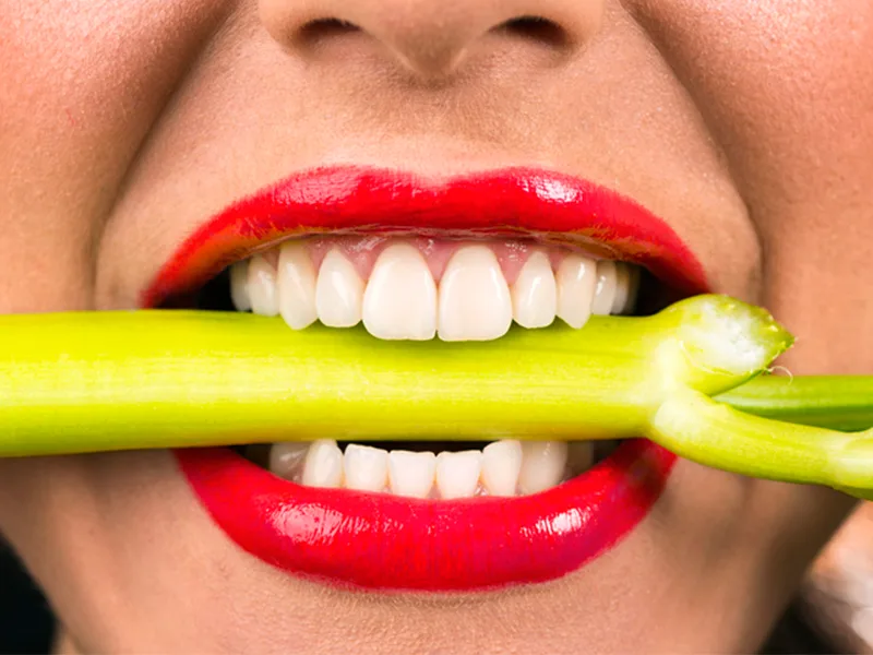 مراقبت های بعد از کامپوزیت دندان