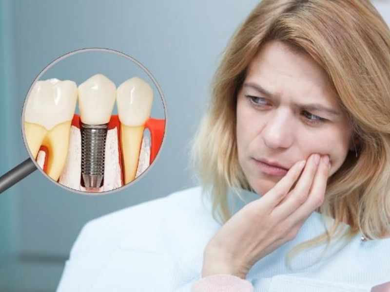 مسکن قوی برای درد ایمپلنت