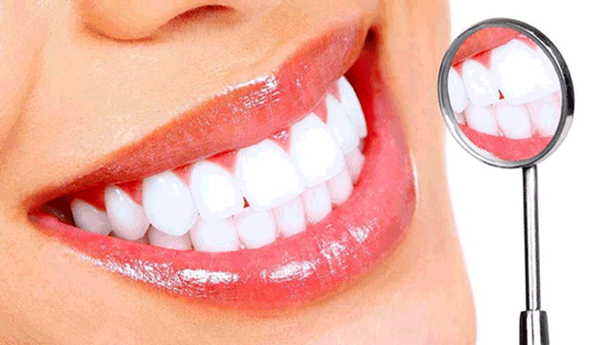 کامپوزیت دندان چیست