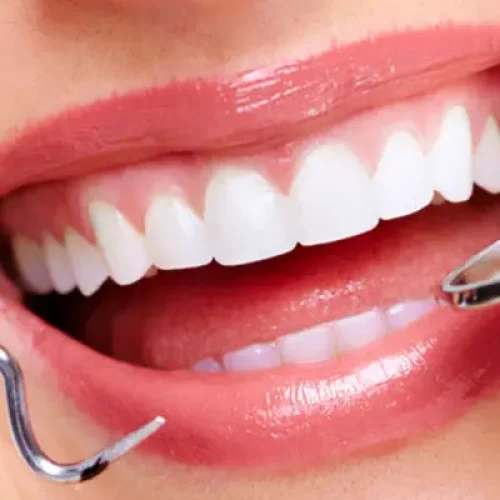 دندانپزشکی زیبایی چیست