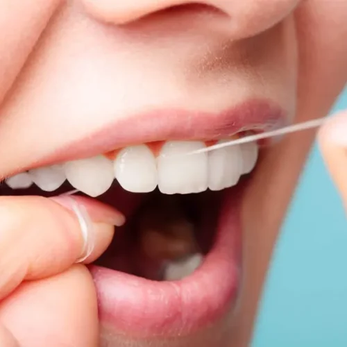 مراقبت های بعد از کامپوزیت دندان