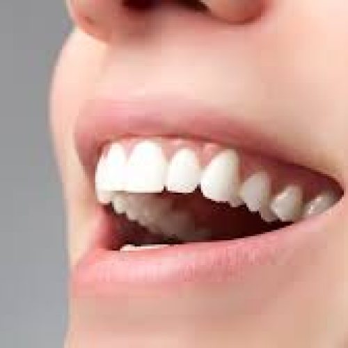 هزینه بیمه ایمپلنت