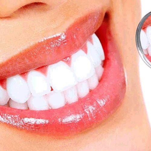 کامپوزیت دندان چیست